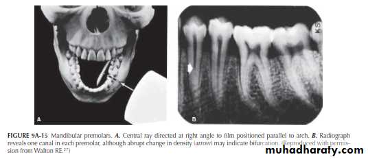 INTERPRETATION OF ENDODONTIC RADIOGRAPH
