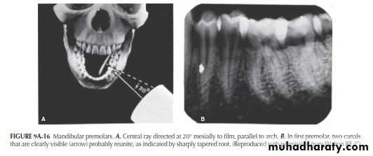 INTERPRETATION OF ENDODONTIC RADIOGRAPH
