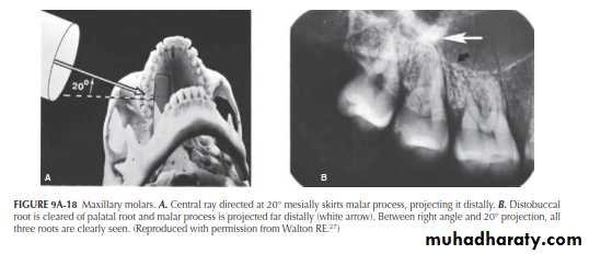 INTERPRETATION OF ENDODONTIC RADIOGRAPH