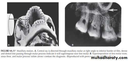 INTERPRETATION OF ENDODONTIC RADIOGRAPH