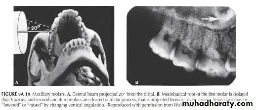 INTERPRETATION OF ENDODONTIC RADIOGRAPH