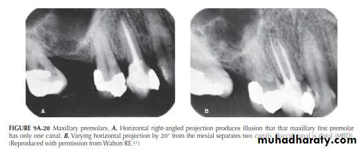 INTERPRETATION OF ENDODONTIC RADIOGRAPH