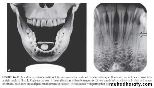 INTERPRETATION OF ENDODONTIC RADIOGRAPH