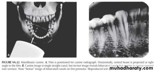 INTERPRETATION OF ENDODONTIC RADIOGRAPH