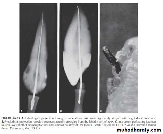 INTERPRETATION OF ENDODONTIC RADIOGRAPH