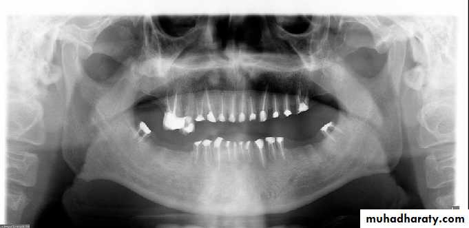 INTERPRETATION OF ENDODONTIC RADIOGRAPH