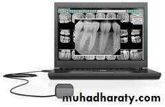 INTERPRETATION OF ENDODONTIC RADIOGRAPH
