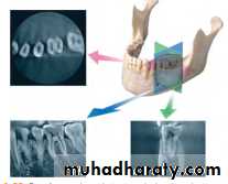 INTERPRETATION OF ENDODONTIC RADIOGRAPH