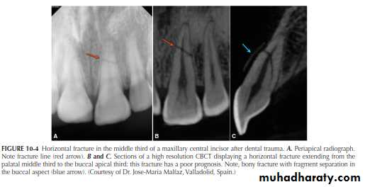 INTERPRETATION OF ENDODONTIC RADIOGRAPH
