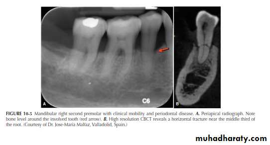 INTERPRETATION OF ENDODONTIC RADIOGRAPH