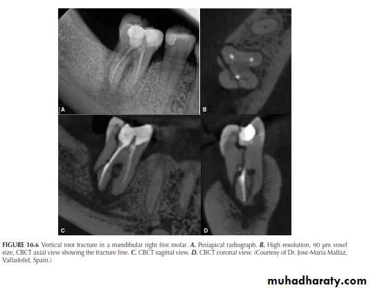 INTERPRETATION OF ENDODONTIC RADIOGRAPH