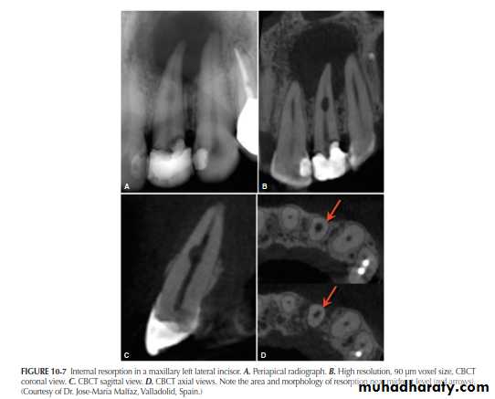 INTERPRETATION OF ENDODONTIC RADIOGRAPH