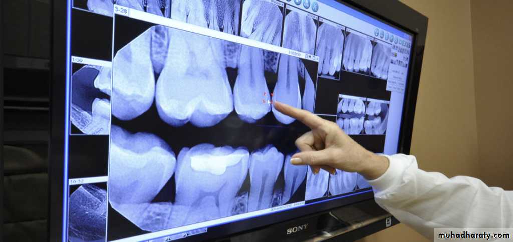 INTERPRETATION OF ENDODONTIC RADIOGRAPH