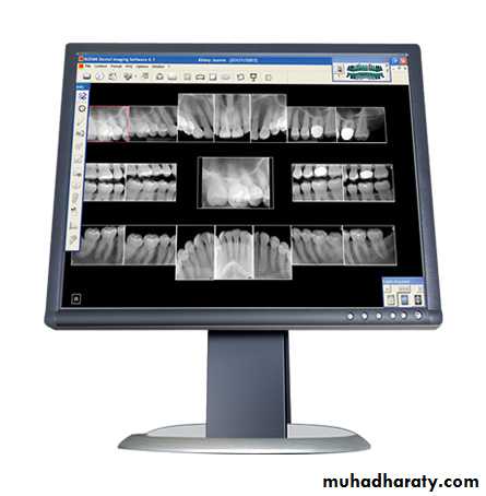 INTERPRETATION OF ENDODONTIC RADIOGRAPH