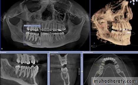 INTERPRETATION OF ENDODONTIC RADIOGRAPH