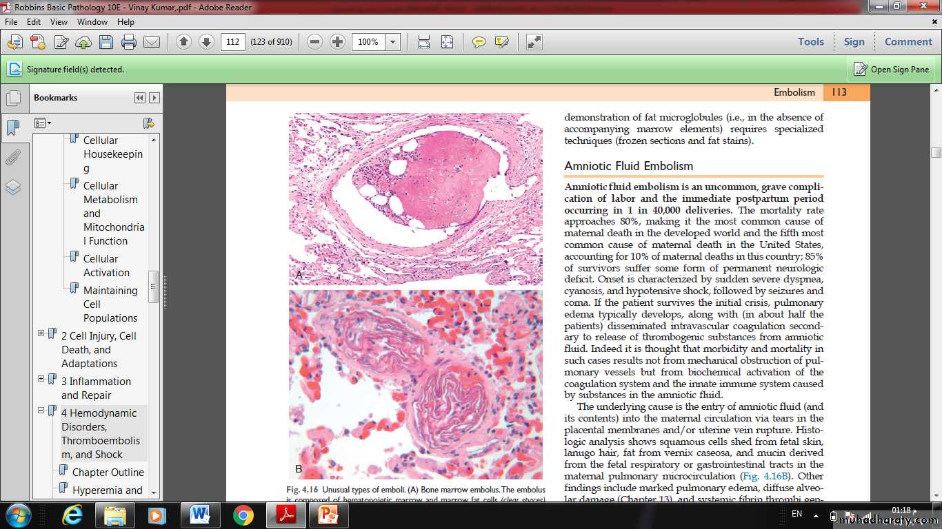 Lec 5
