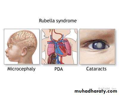 Rubella and Congenital Viral Infections