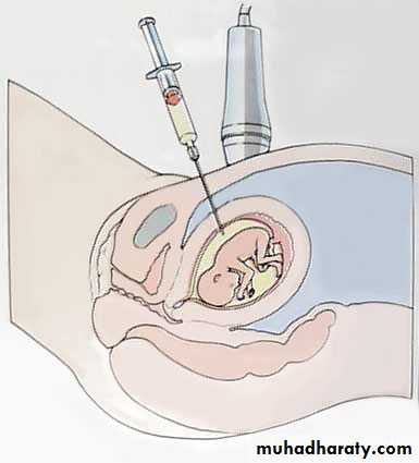 Rubella and Congenital Viral Infections