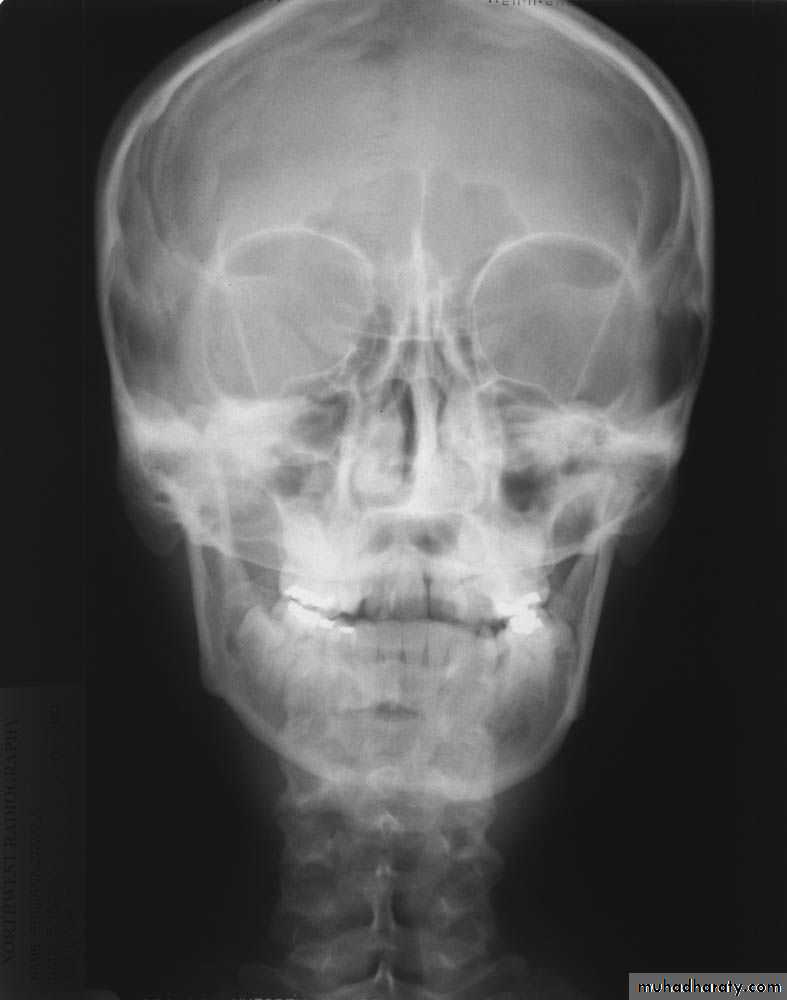 Skull and Brain Imaging