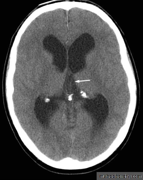 Skull and Brain Imaging