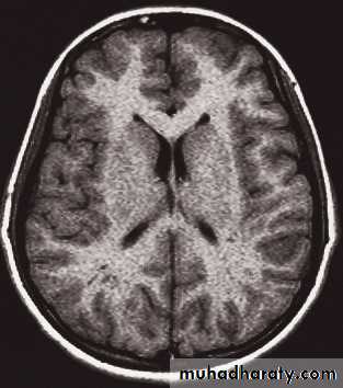 Skull and Brain Imaging