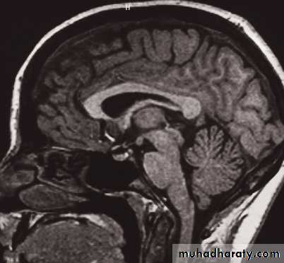 Skull and Brain Imaging