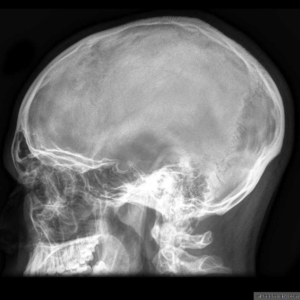 Skull and Brain Imaging
