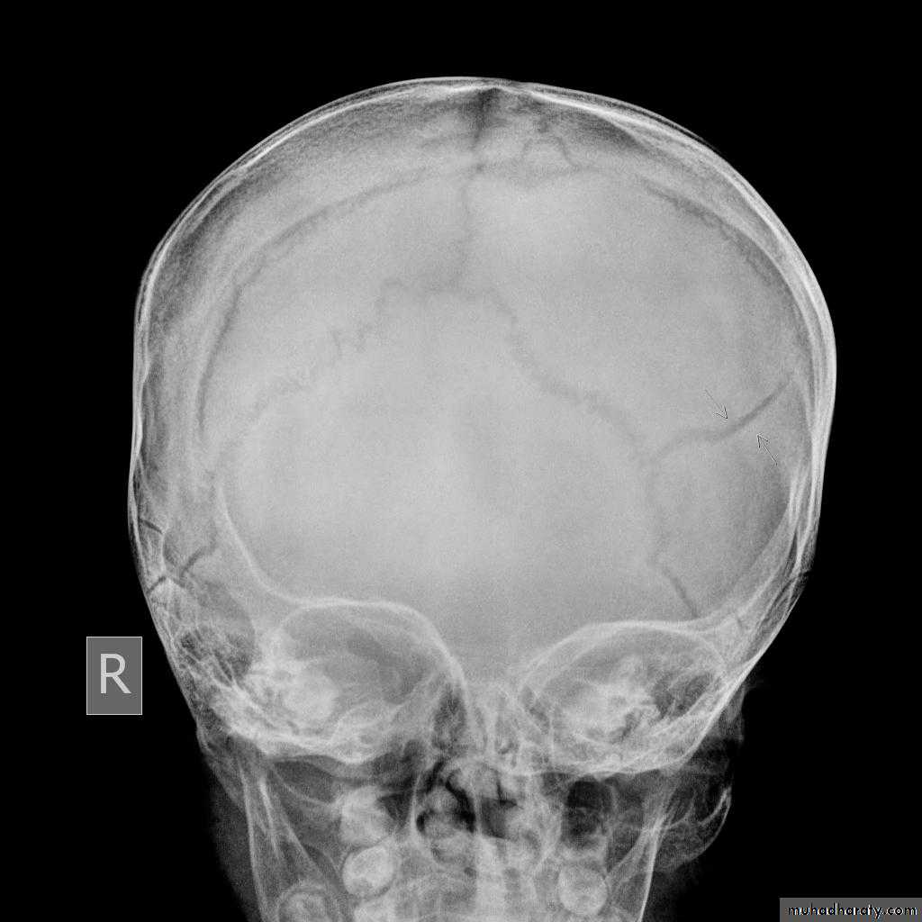 Skull and Brain Imaging