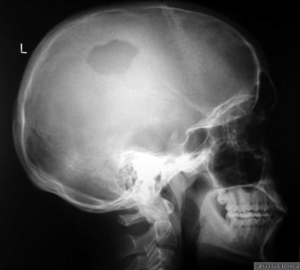 Skull and Brain Imaging