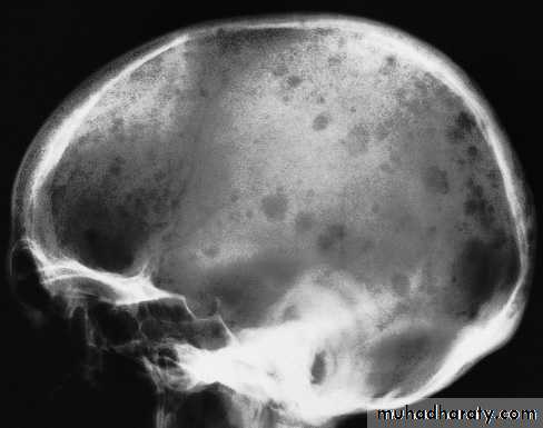 Skull and Brain Imaging