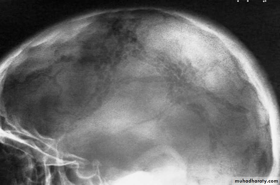 Skull and Brain Imaging