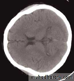 Skull and Brain Imaging