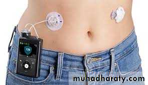 Insulin Therapy