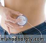 Insulin Therapy