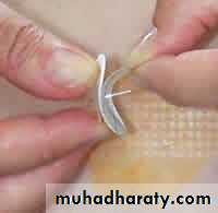 Insulin Therapy