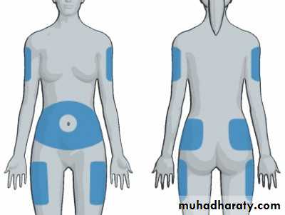 Insulin Therapy