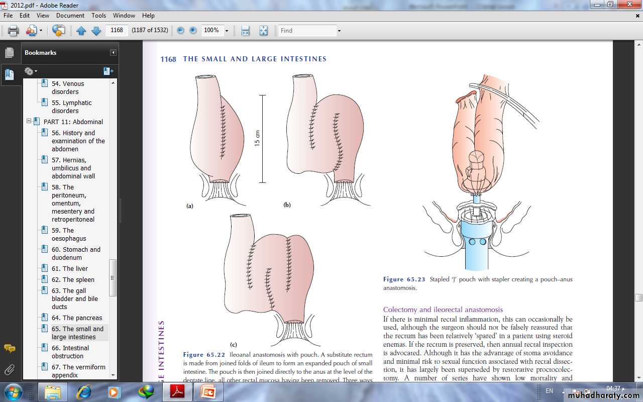 Small and large Bowel