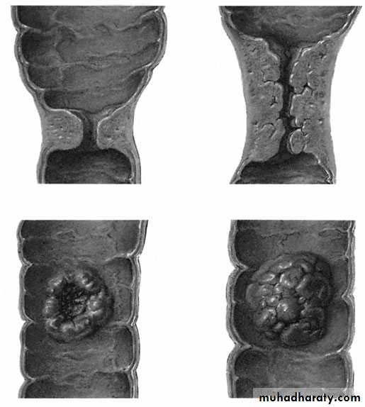 Small and large Bowel