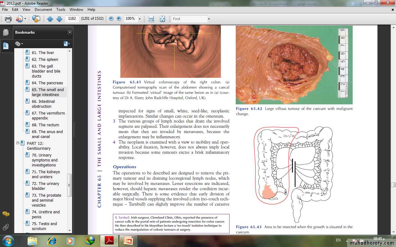 Small and large Bowel