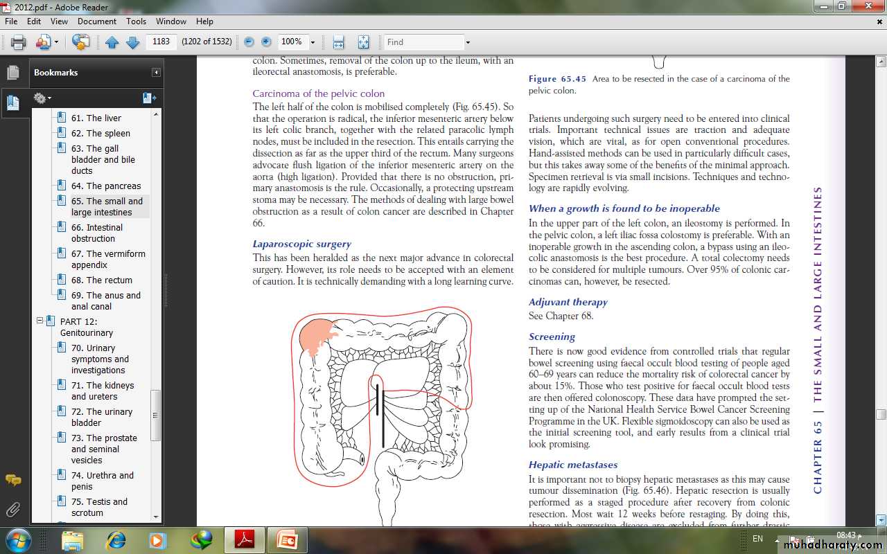 Small and large Bowel