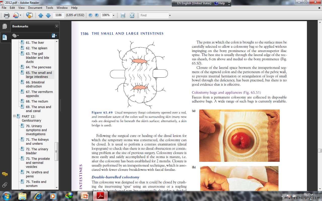 Small and large Bowel