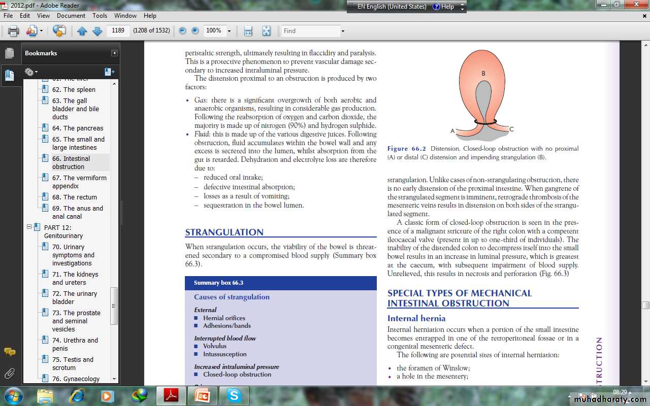 Small and large Bowel