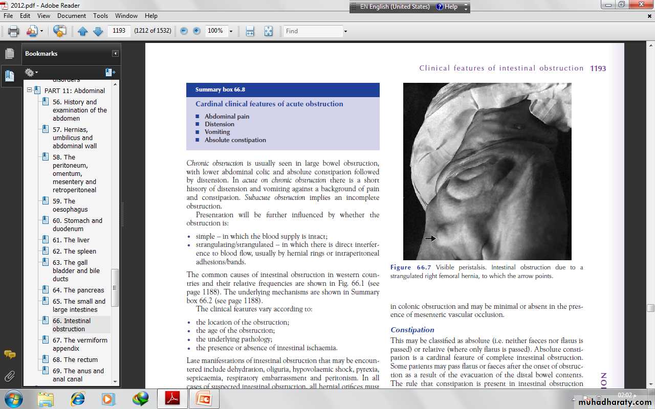 Small and large Bowel