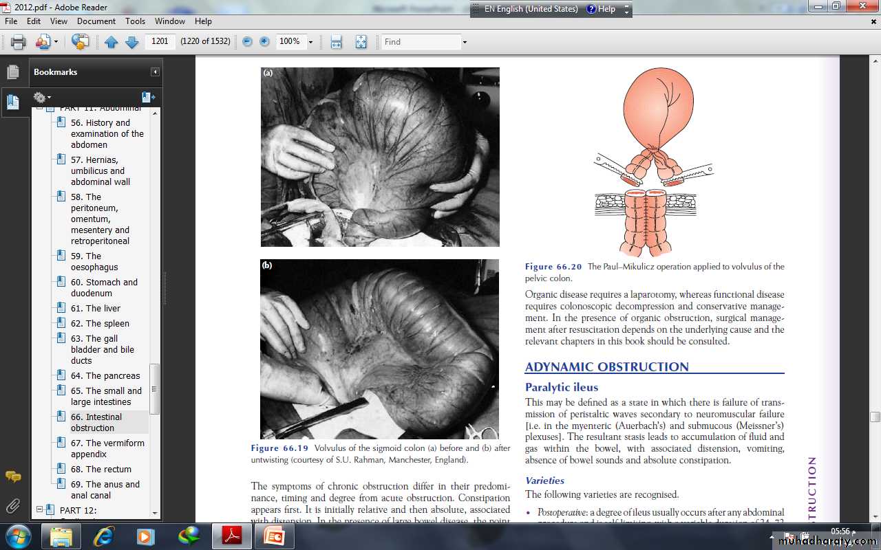 Small and large Bowel