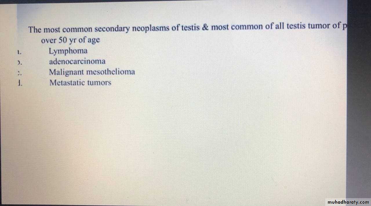Testicular Tumor