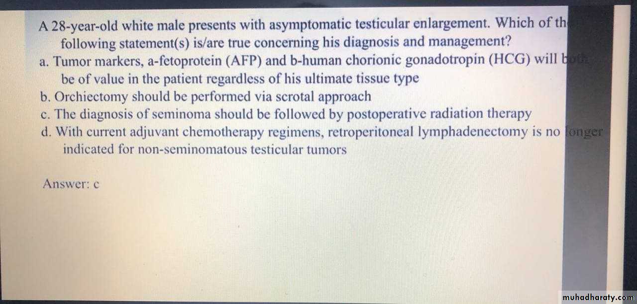 Testicular Tumor