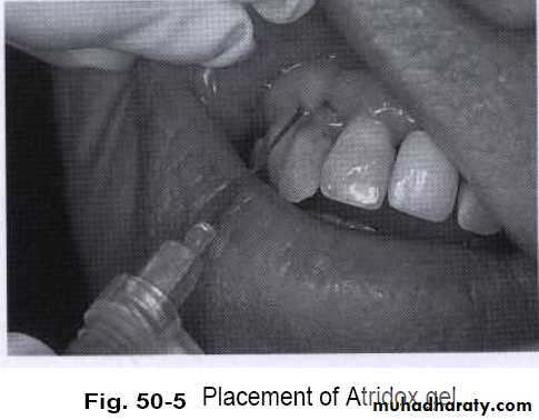 medicaments for periodontal diseases