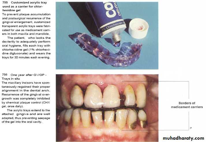 medicaments for periodontal diseases