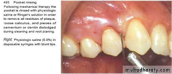 medicaments for periodontal diseases