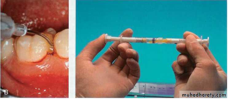 medicaments for periodontal diseases